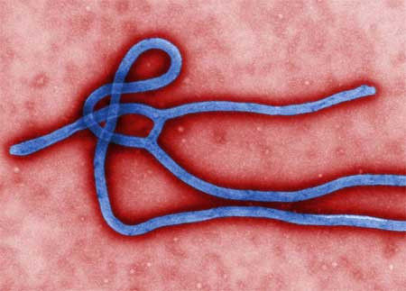 Virus Ebola thuộc loại nguy hiểm nhất hiện nay vì chưa có vắc-xin phòng ngừa và cũng chưa có thuốc điều trị đặc hiệu. Ảnh: Live Science
