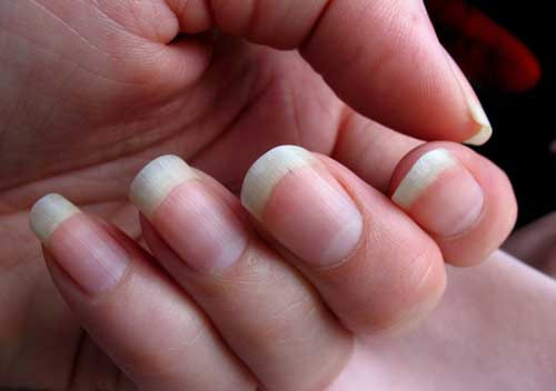 Móng tay có thể phát triển nhanh hơn so với móng chân tùy theo đặc điểm giới tính, chế độ ăn uống hay di truyền. Ảnh minh họa: Flickr.