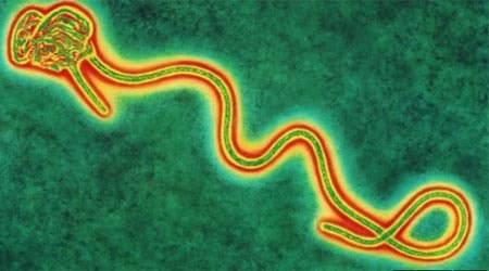 Virus Ebola. Ảnh: BBC