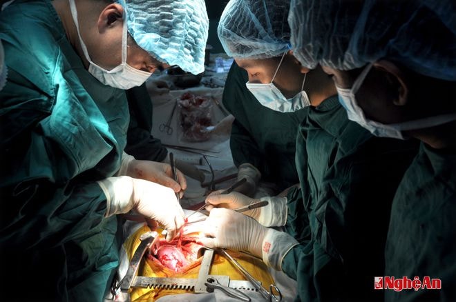 Một ca ghép thận tại Bệnh viện Hữu nghị Đa khoa Nghệ An. Ảnh: T.T