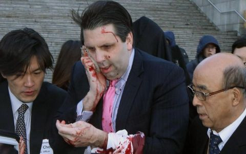 Đại sứ Mark Lippert bị tấn công (Ảnh AFP)