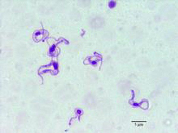 Trùng roi Trypanosoma evansi (Nguồn: digplanet)