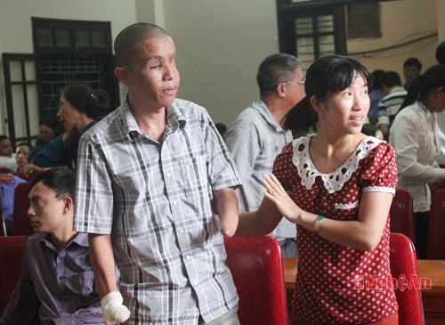 Bị hại Hảo – Người bị tổn hại 98% sức khỏe do vụ nổ mà Đệ gây ra đến   tham dự phiên tòa