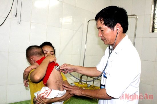 BSCKII Nguyễn Văn Sơn đang khám cho bệnh nhân bị bệnh tay chân miệng