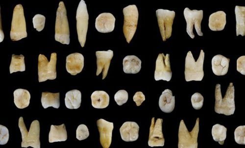  Mẫu răng hóa thạch tìm thấy ở Trung Quốc. Ảnh: Live Science