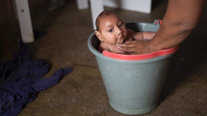 Em bé Jose Wesley bị chứng đầu nhỏ vì mẹ em bị nhiễm vi rút Zika trong thời gian mang bầu đang tắm tại nhà ở Poco Fundo, bang Pernambuco, Brazil - Ảnh: AP