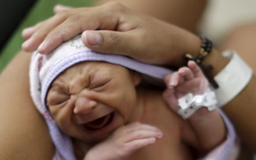 Giới chuyên gia y tế cho rằng virus Zika có liên quan đến căn bệnh teo não ở trẻ sơ sinh. (Ảnh: Reuters)