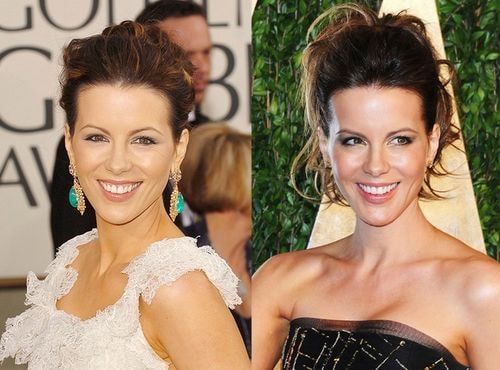 Gương mặt diễn viên Kate Beckinsale sau 10 năm (2006 - 2016).