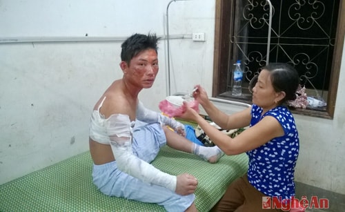 Bệnh nhân Vi Khắc Nhớ đang điều trị tại bệnh viện.