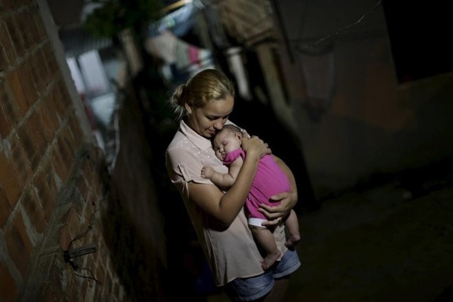 Trẻ em bị mắc virus Zika. Ảnh: Reuters.