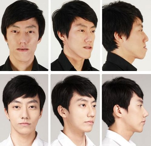 cac-chang-trai-han-dep-hon-han-sau-khi-got-cam-nang-mi-9