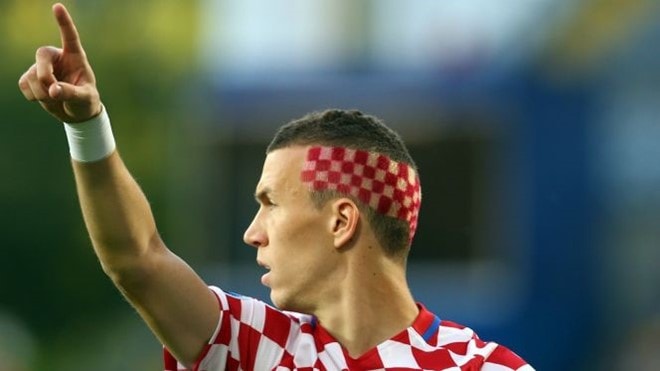 11 kiểu tóc cá tính nhất Euro 2016 hình ảnh 5 11 kieu toc ca tinh nhat Euro 2016 hinh anh 5