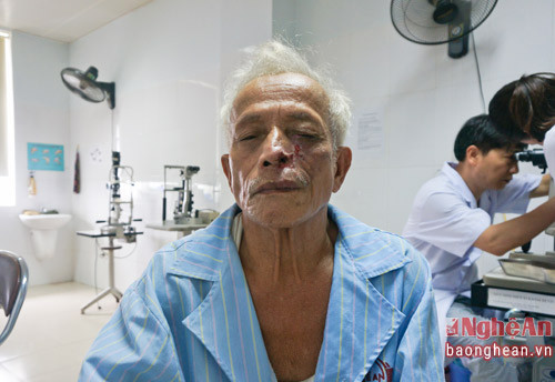 Sau 4 ngày điều trị, da mặt của bệnh nhân Lý đã đỡ nhiễm trùng và hoại tử.