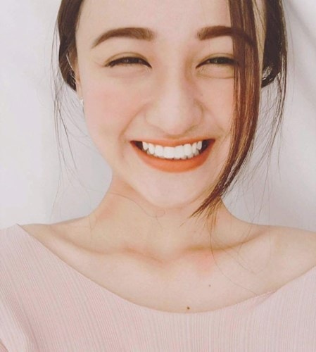 Nụ cười rạng rỡ, đôi mắt
