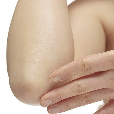 Kiểm tra những nơi ít để ý: Gập khuỷu tay và kiểm tra kỹ lưỡng cánh tay, nách, lòng bàn tay vì những nơi này rất dễ bị u sắc tố ALM. Lòng bàn chân, móng chân, tay cũng là nơi bạn cần chú ý. 