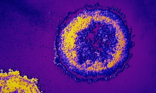 Hình ảnh virus HIV trong cơ thể người. Ảnh: Getty.