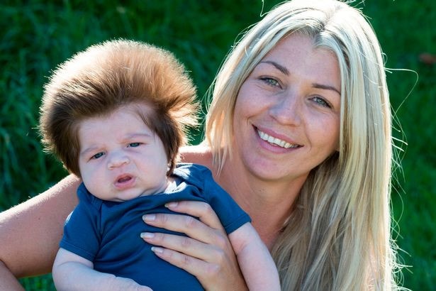Mẹ của bé, chị Chelsea Noon cho biết, mỗi khi chị đưa Junior ra ngoài, nhiều người đã nhìn chằm chằm vào bé và không giấu nổi sự ngạc nhiên.(ảnh: Daily Mirror/David Hill).