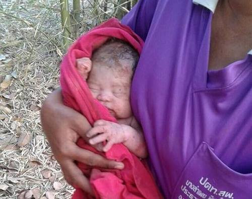 Bé sơ sinh được giải cứu trong tình trạng bị thương nặng và bị chôn sống. Ảnh:Exclusivepix Media