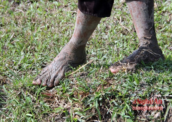 Bàn chân hằn những nhăn nheo tưởng chừng như già hơn cả tuổi đời của bà cụ.