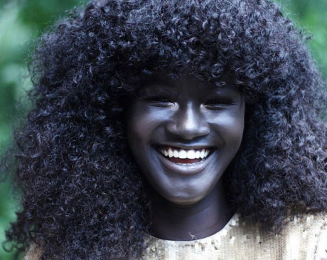 Khoudia Diop vốn sở hữu làn da đen nhánh đúng nghĩa, đen hơn nhiều so với đa số người da màu. Từ nhỏ Diop đã thường xuyên bị bạn bè trêu chọc, chê cười vì làn da khác người
