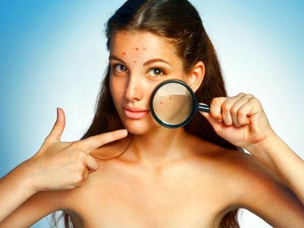 Công dụng bất ngờ của bột lá xoan ảnh 3