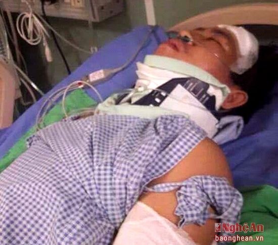Anh Bình nằm điều trị tại Bệnh viện Cao Hùng (Đài Loan) trong tình trạng hôn mê.