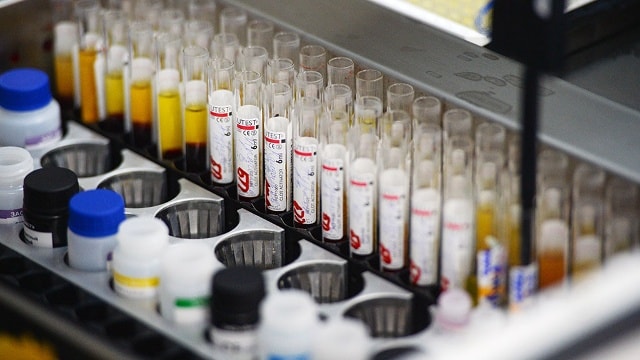 Gammora có thể là protein loại bỏ được hoàn toàn virus HIV. Ảnh Getty