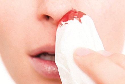Những biểu hiện bị ung thư máu mà bạn cần biết ảnh 5