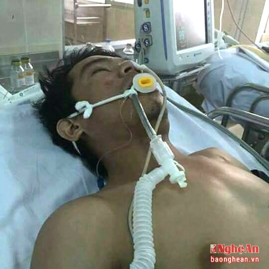 Nguyễn Bá Đạo thời điểm được cấp cứu tại Bệnh viện Chợ Rẫy.