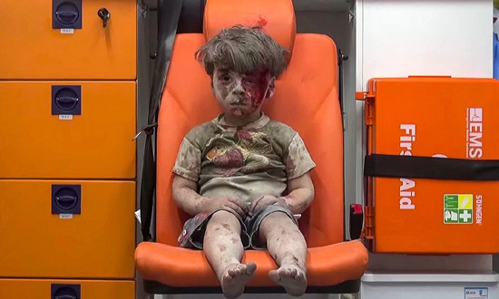 Omran Daqneesh là 1 trong 5 đứa trẻ bị thương sau cuộc không kích vào tối 17/8 /2016 của quân đội chính phủ ở khu vực Qaterji thuộc thành phố Aleppo, phía bắc Syria.. Ảnh: Getty
