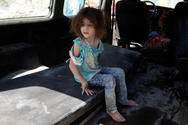 Một cô gái bị thương ngồi trong một chiếc xe sau khi sống sót không kích đúp vào các phiến quân đã tổ chức khu vực Bab al-Nairab Aleppo, Syria, ngày 27 tháng 8 năm 2016. REUTERS 