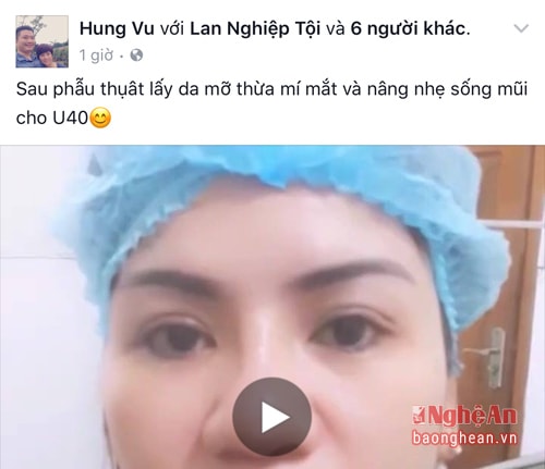 Trên trang facebook cá nhân của bác sĩ Hùng thường xuyên đăng tải hình ảnh khách sau khi được bác sĩ Hùng phẫu thuật thẩm mỹ.