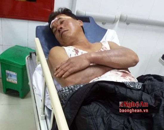 Anh Trung được người dân đưa đi cấp cứu tại bệnh viện HNĐK Nghệ An. Ảnh: Trần Thu