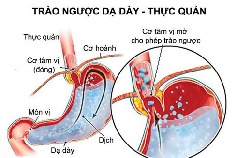 nhung nguoi tuyet doi khong nen uong sua hinh 1