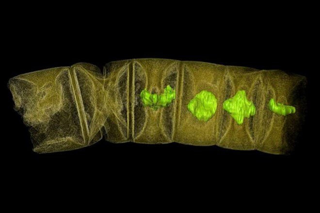 Ảnh chụp tia X hóa thạch giống tảo đỏ. (Ảnh: Reuters).