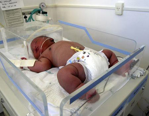 Ngày 18.1.2005, một bé sơ sinh nặng 7,6kg chào đời tại bệnh viện Phụ sản Sabin Albert ở Salvador, 900 dặm về phía đông bắc của thành phố Sao Paulo ở bang Bahia, Brazil. Chị Francisca Ramos dos Santos, 38 tuổi, đã sinh ra cậu bé khỏe mạnh và đặt tên là Ademilton. Em bé là trẻ sơ sinh lớn nhất chào đời trong lịch sử 12 năm của bệnh viện.