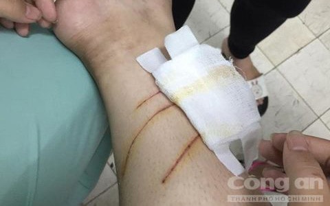 nu sinh bi cat tai va danh dap da man giua sai gon hinh 2