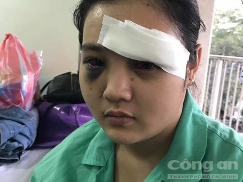Em Trúc đang được điều trị tại bệnh viện Chợ Rẫy