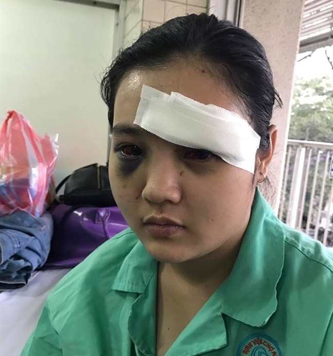 Nạn nhân Trúc bị thương nặng ở phần đầu phải khâu 14 mũi, tai bị cắt gần đứt khâu 8 mũi, ngực bị đam một nhát dao, chân bị 3 nhát, gãy cung xương sườn.