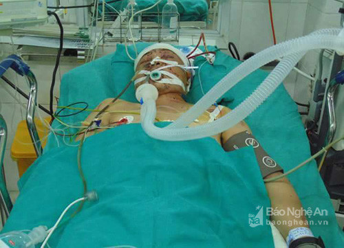 AAnh Hồ Văn Nhiệu - con trai ông Hồ Văn Điều trong tình trạng nguy kịch do tai nạn giao thông đang được điều trị tại Bệnh viện Việt Đức, Hà Nội.