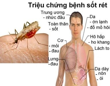 Muỗi là vật trung gian gây bệnh sốt rét.