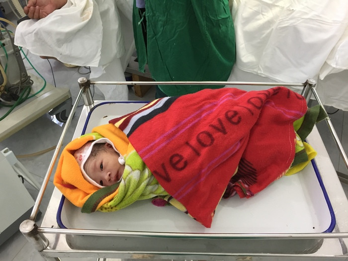 Cháu bé sinh ra được 1,9 kg trong ca mổ đầy căng thẳng của các y, bác sỹ Trung tâm y tế huyện Quế Phong. Ảnh: Hùng Cường