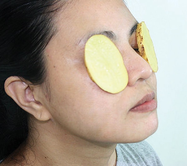 Khoai tây đắp mắt cũng là một cách bổ sung dinh dưỡng