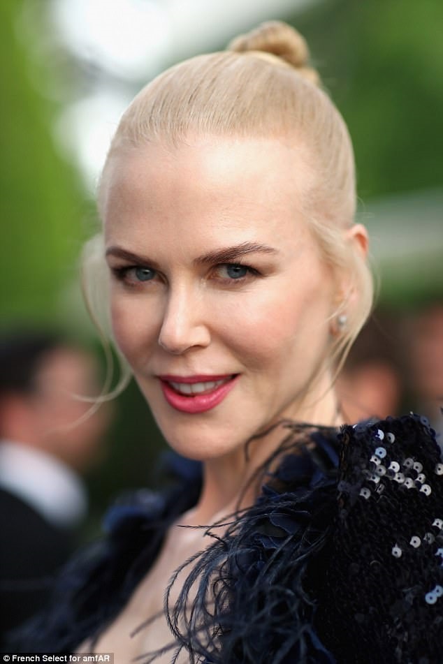 Nicole Kidman dung tiem botox vi khong the cu dong tran hinh anh 1
