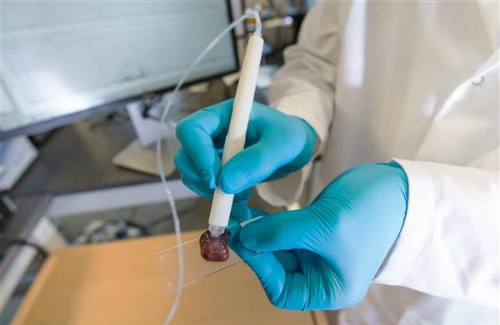 Bút MasSpec Pen có thể phát hiện ung thư trong 10 giây. Ảnh: Texas University.