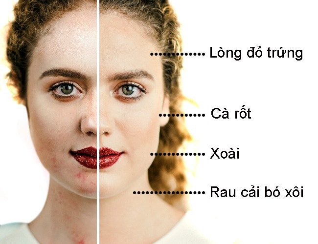 bac-si-da-lieu-chi-diem-cac-loai-thuc-phm-tri-moi-van-de-da-1