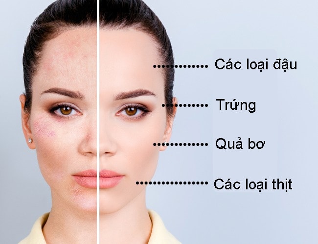 bac-si-da-lieu-chi-diem-cac-loai-thuc-phm-tri-moi-van-de-da-3