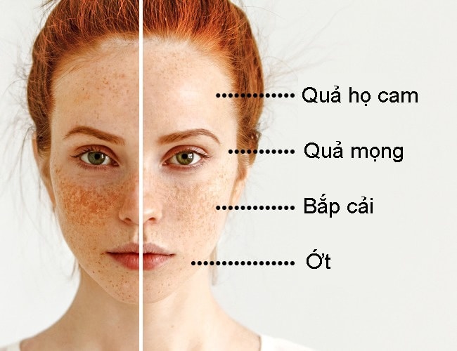bac-si-da-lieu-chi-diem-cac-loai-thuc-phm-tri-moi-van-de-da