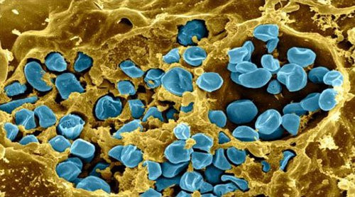Vi khuẩn gây bệnh tularemia 