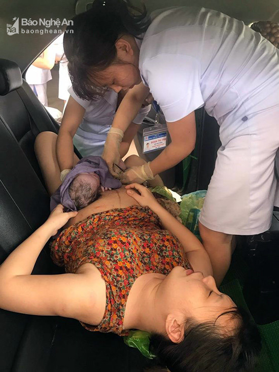 Các nữ hộ sinh Bệnh viện Đa khoa 115 Nghệ An cắt rốn cho em bé ngay tại xe taxi. Ảnh: Bệnh viện Đa khoa 115 cung cấp